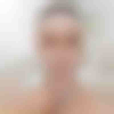 Bande de lifting sculptante pour le visage | KIMLIFT